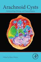 Cover for Arachnoid Cysts